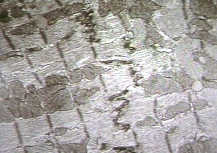 00205976