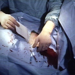Patient