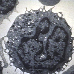 Electron Microscopy