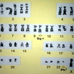 Karyotype