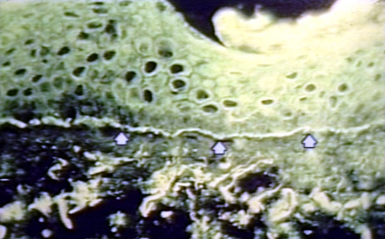 00212644