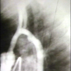PEIR Slice