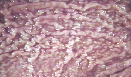 00215581