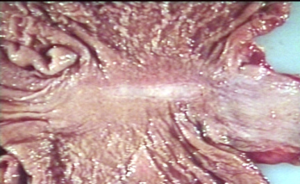 00215584