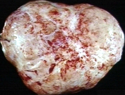 00221084