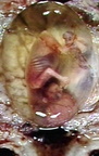 Embryo-Fetus