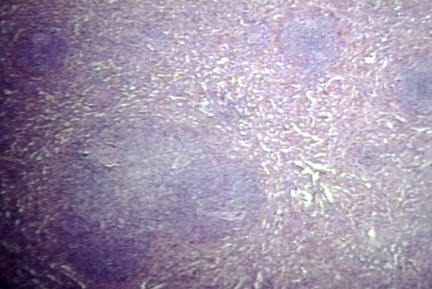 00223518