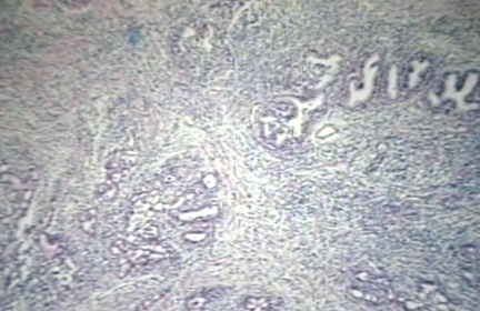 00225214