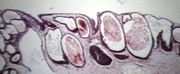 00225280