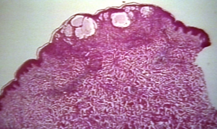00225282