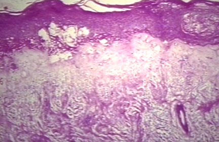 00225283