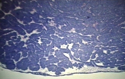 00225285