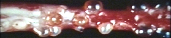 00225309