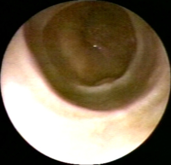 00226817