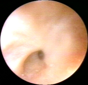 00226841