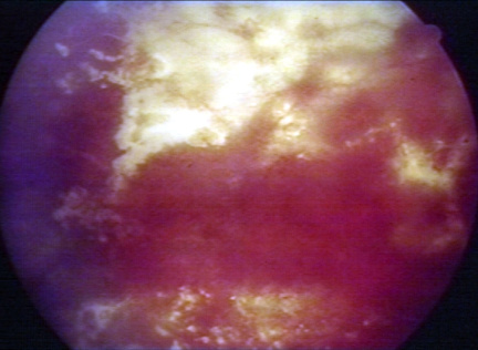 00232386