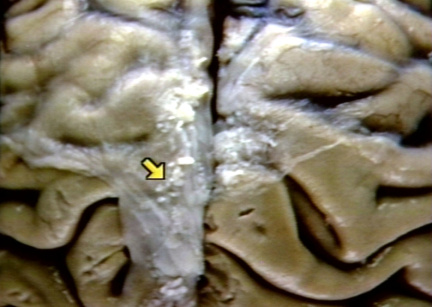 00232615