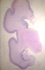 00237498