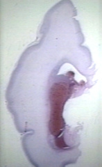 00237509