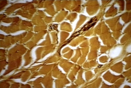 00241639