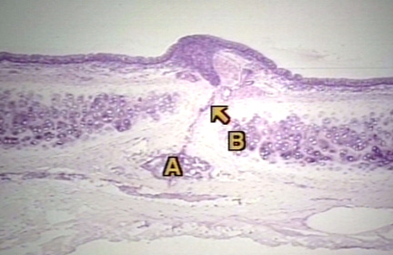 00244382
