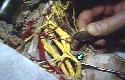 00244539