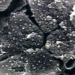 Electron Microscopy