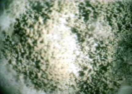 00246236