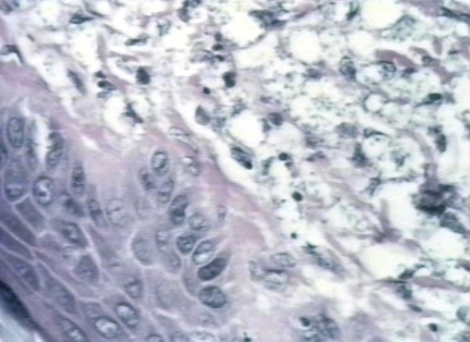 00246241