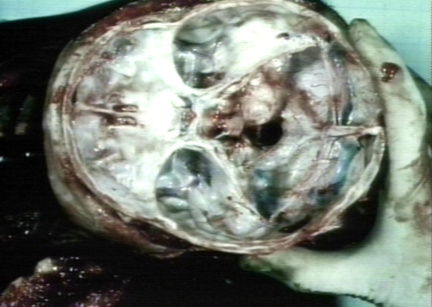 00246328