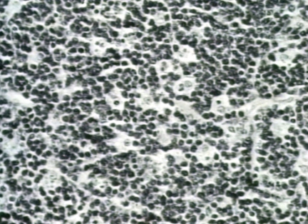 00246332