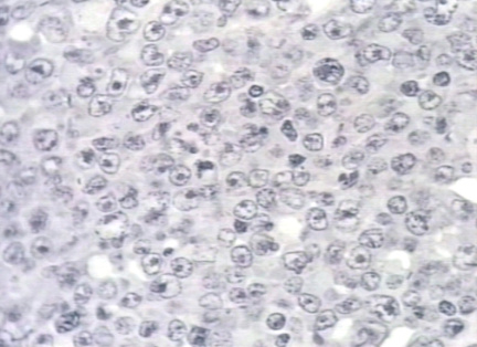 00246335