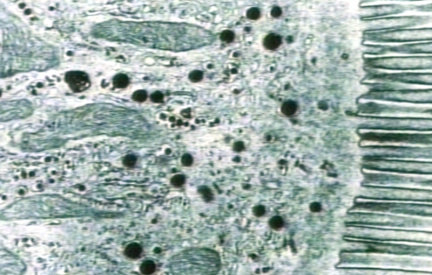 00246435