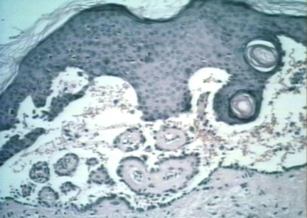 00246514