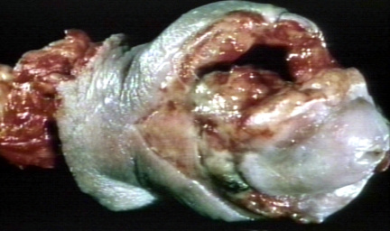 00246525