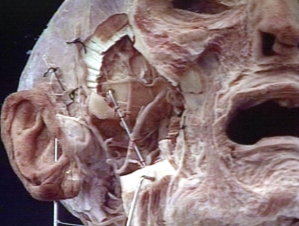 00246785