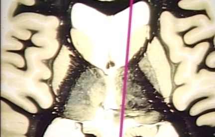 00248951