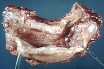 00249154