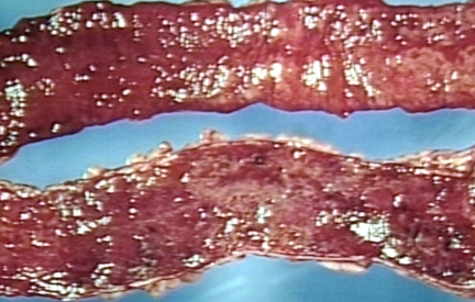 00249203