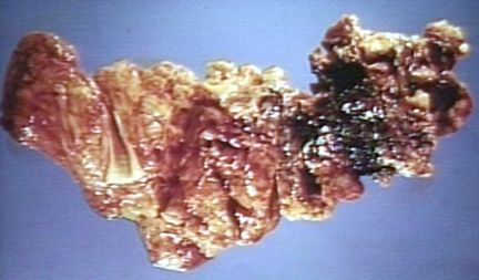 00249232
