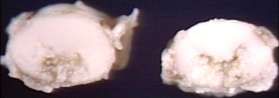 00249562