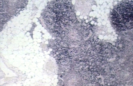 00250444