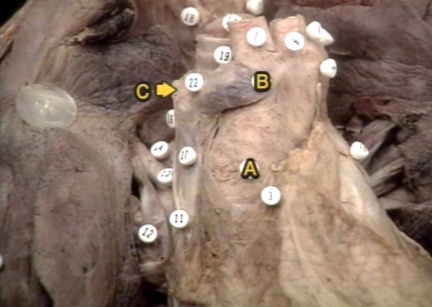 00250971