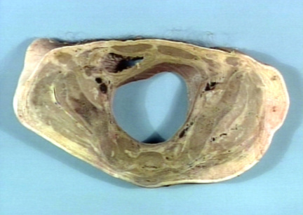 00252684