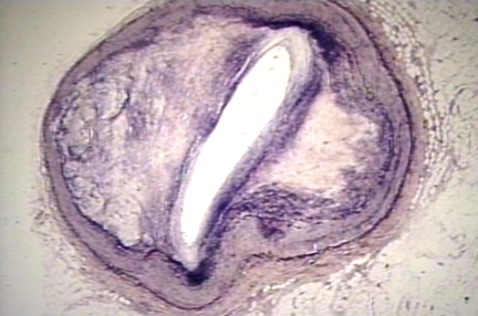 00253262