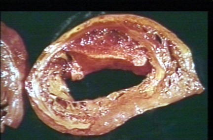 00253281