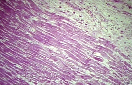 00253292