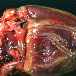 PEIR Pathology